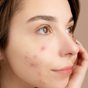 Problemas de la piel